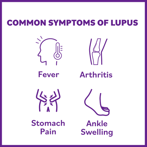 Lupus Basics